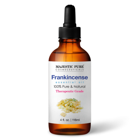 Frankincense Oil